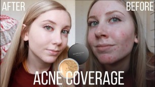 'How I cover my acne! | with bare minerals powder foundation!'