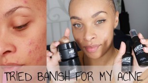 'I TRIED BANISH FOR ONE WEEK - ACNE PRONE SKIN - BEFORE & AFTERS'