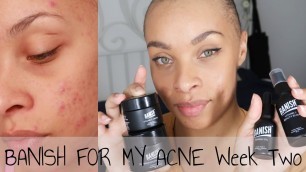 'I TRIED BANISH - WEEK TWO - ACNE PRONE SKIN'