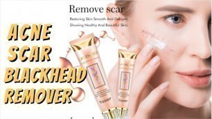 'hot and flashy skin care 2019 - banish acne scars (best organic skincare products 2019) ACNE REMOVAL'