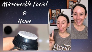 'Microneedle Facial | Banish Acne Scars, Eminence Organics skincare | Kelci Taylor'