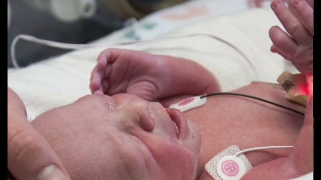 'First Uterus Transplant Baby Born in the U.S. at Baylor University Medical Center at Dallas'