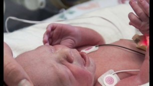 'First Uterus Transplant Baby Born in the U.S. at Baylor University Medical Center at Dallas'