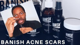 'BANISH ACNE SCARS REVIEW | DOES IT WORK? THE HONEST TRUTH'