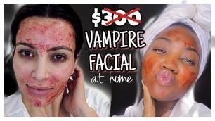 'VAMPIRE FACIAL AT HOME | SKIN MICRONEEDLING | BANISH SKINCARE'