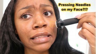 'My Daytime Skincare Routine | skin update pt.2 | Banish'