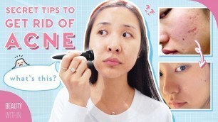 'Banish CEO\'s Acne Story on How to Clear Hormonal Acne, Scarring & Hyperpigmentation (ft. Daisy Jing)'