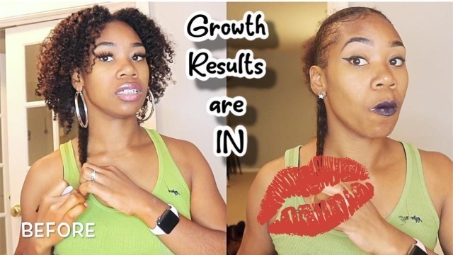 'Hair Growth Results | Ayurvedic 30 day Growth Challenge'