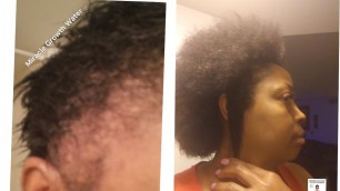 'AMAZING HAIR GROWTH UPDATE/ MIRACLE GROWTH WATER  MAJOR PRICE DROP SALE'